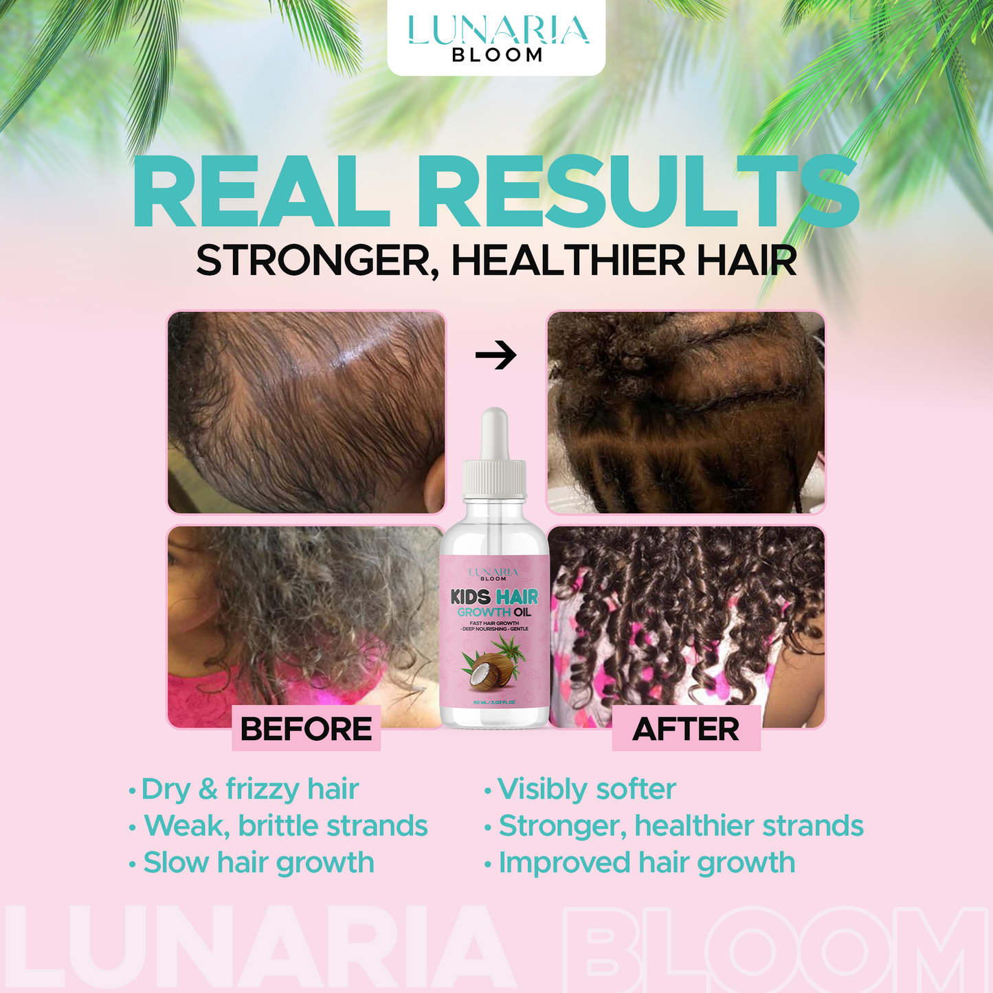 Lunaria Bloom™ Wild Growth Hair Oil For Kids - Castor Oil For Hair Growth - Rosemary Oil For Hair Growth - Gentle Children Hair Care