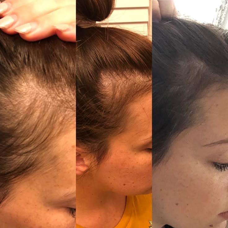 Lunaria Bloom™ Hair Growth & Anti-Breakage Oil for Adults