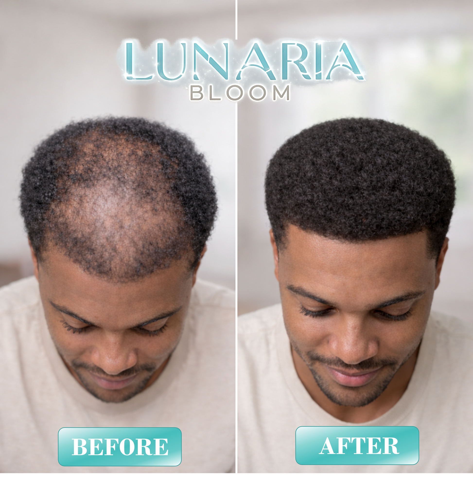 Lunaria Bloom™ Wild Growth Hair Oil - Castor Oil For Hair Growth - Rosemary Oil For Hair Growth - Hair Growth Oil For Women and Men