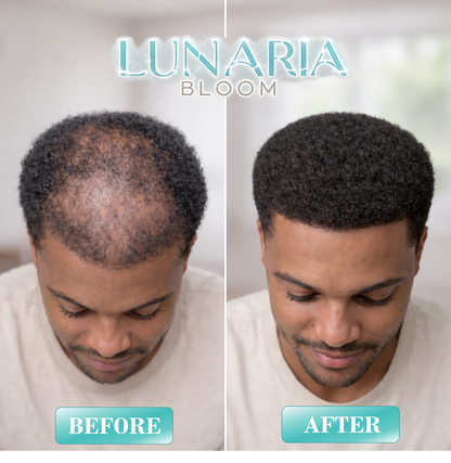 Lunaria Bloom™ Wild Growth Hair Oil - Castor Oil For Hair Growth - Rosemary Oil For Hair Growth - Hair Growth Oil For Women and Men