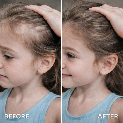 Lunaria Bloom™ Gentle Kids Hair Growth Oil - Nourishes & Strengthens Hair with Castor & Rosemary