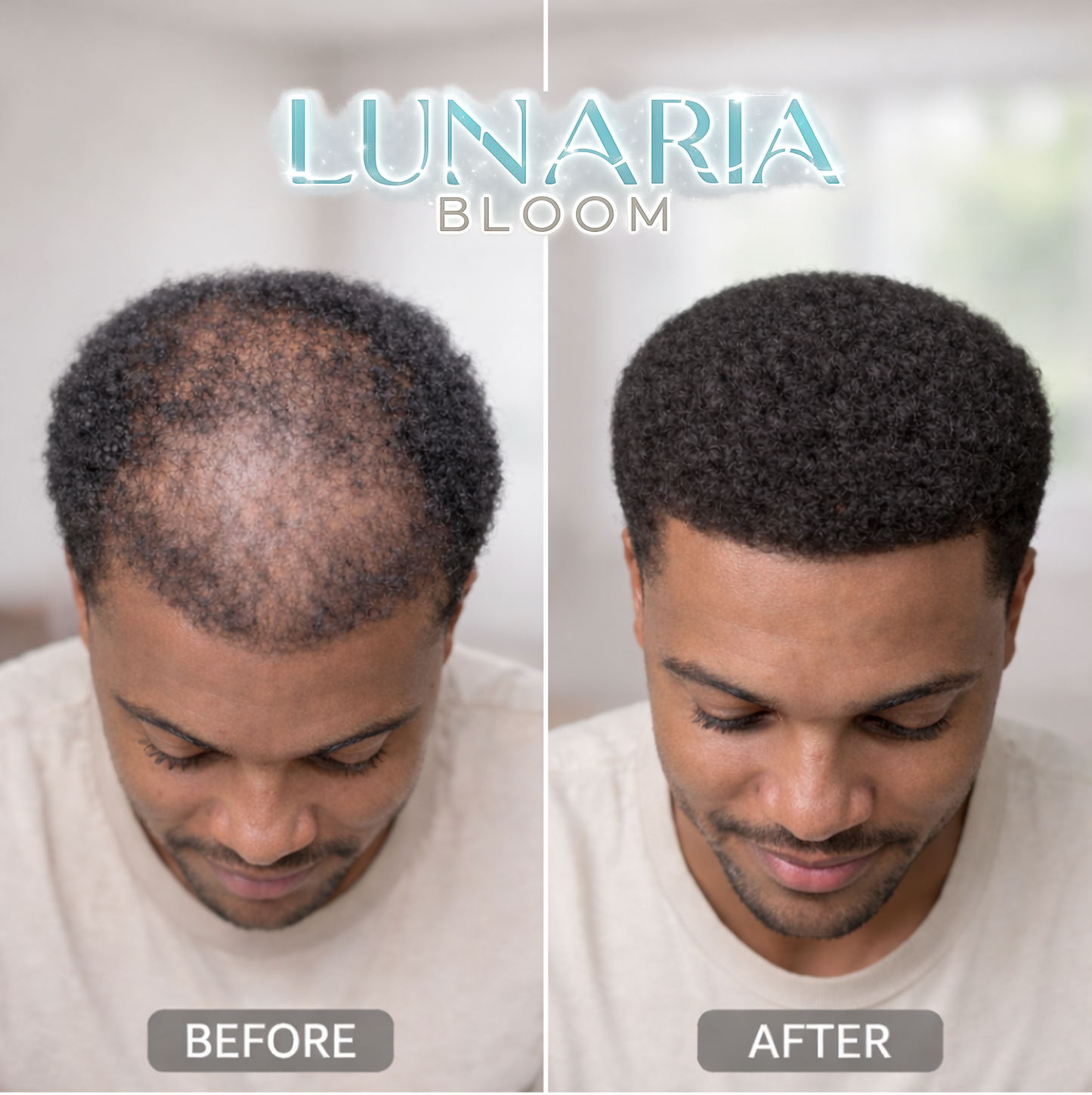 Huile capillaire Lunaria Bloom™ pour adultes aux cheveux secs et abîmés - Huiles de ricin et de romarin répare et fortifie les cheveux